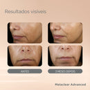 Sérum Facial Clareador Isdin - Melaclear Advanced 30ml