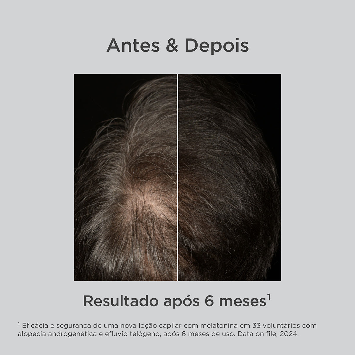 ISDIN Loção Antiqueda com Melatonina Hair Care - 100ml